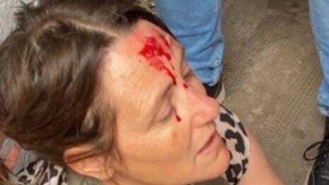 Un joven irrumpió a los golpes y sembró el pánico en el Normal 2 de La Plata